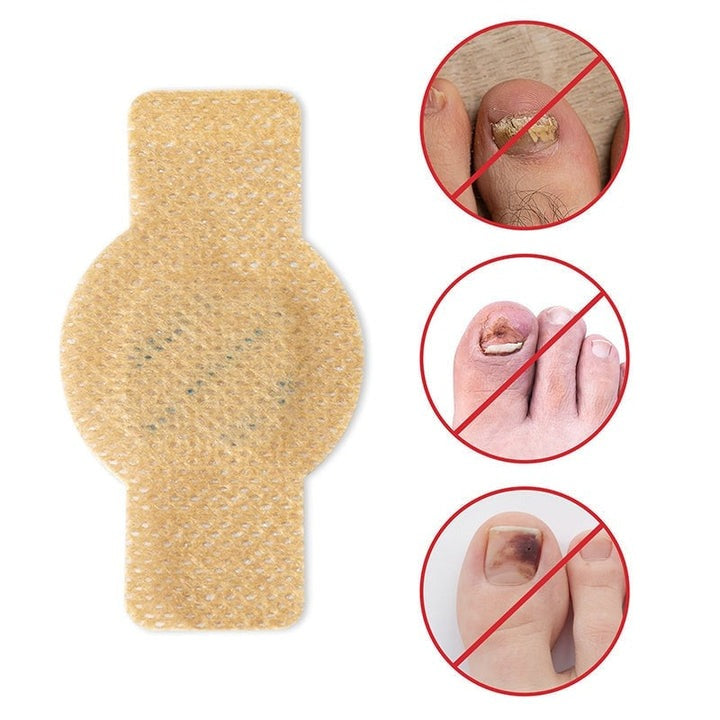 FungalPatch – antibakterielle sopphemmende plaster og neglepleiesett
