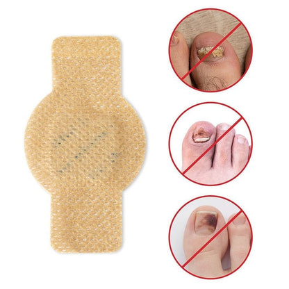 FungalPatch – antibakterielle sopphemmende plaster og neglepleiesett
