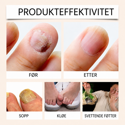 Biegift-spray mot neglesopp