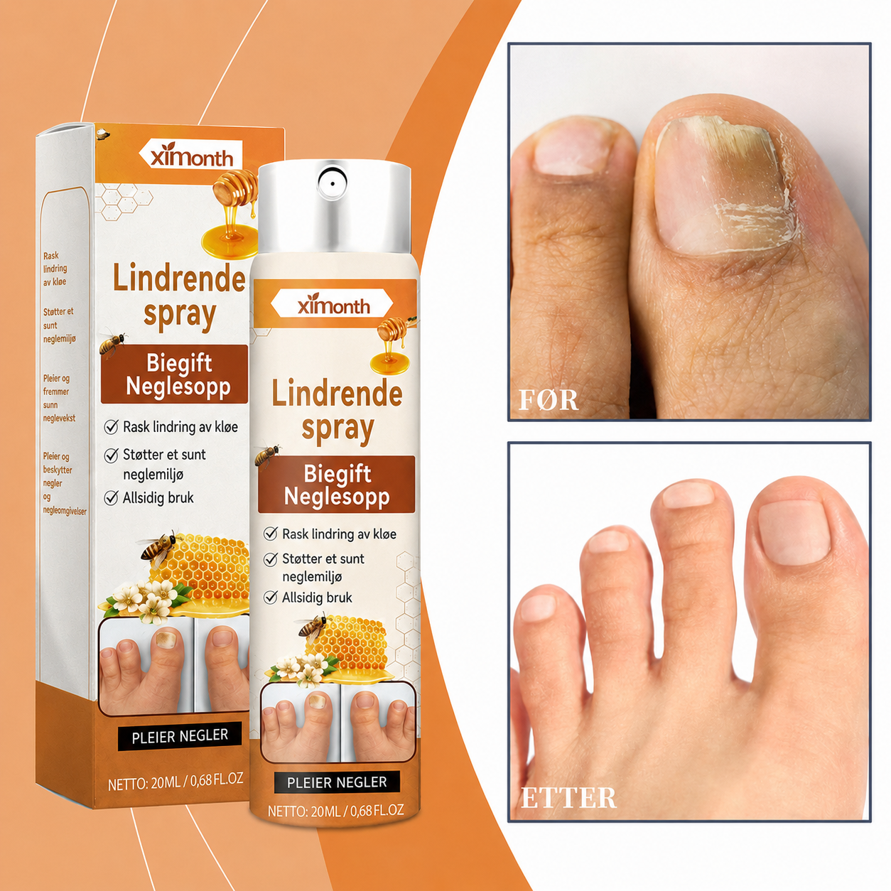 Biegift-spray mot neglesopp