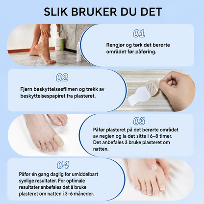 FungalPatch – antibakterielle sopphemmende plaster og neglepleiesett