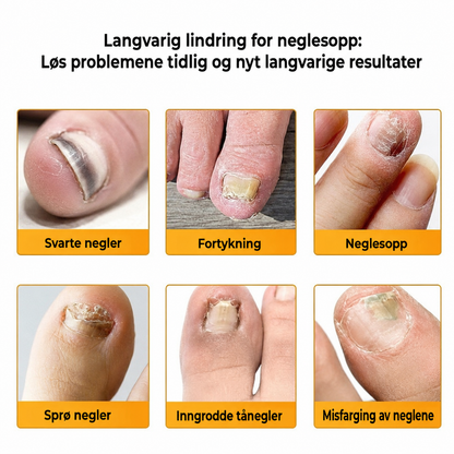 FungalPatch – antibakterielle sopphemmende plaster og neglepleiesett