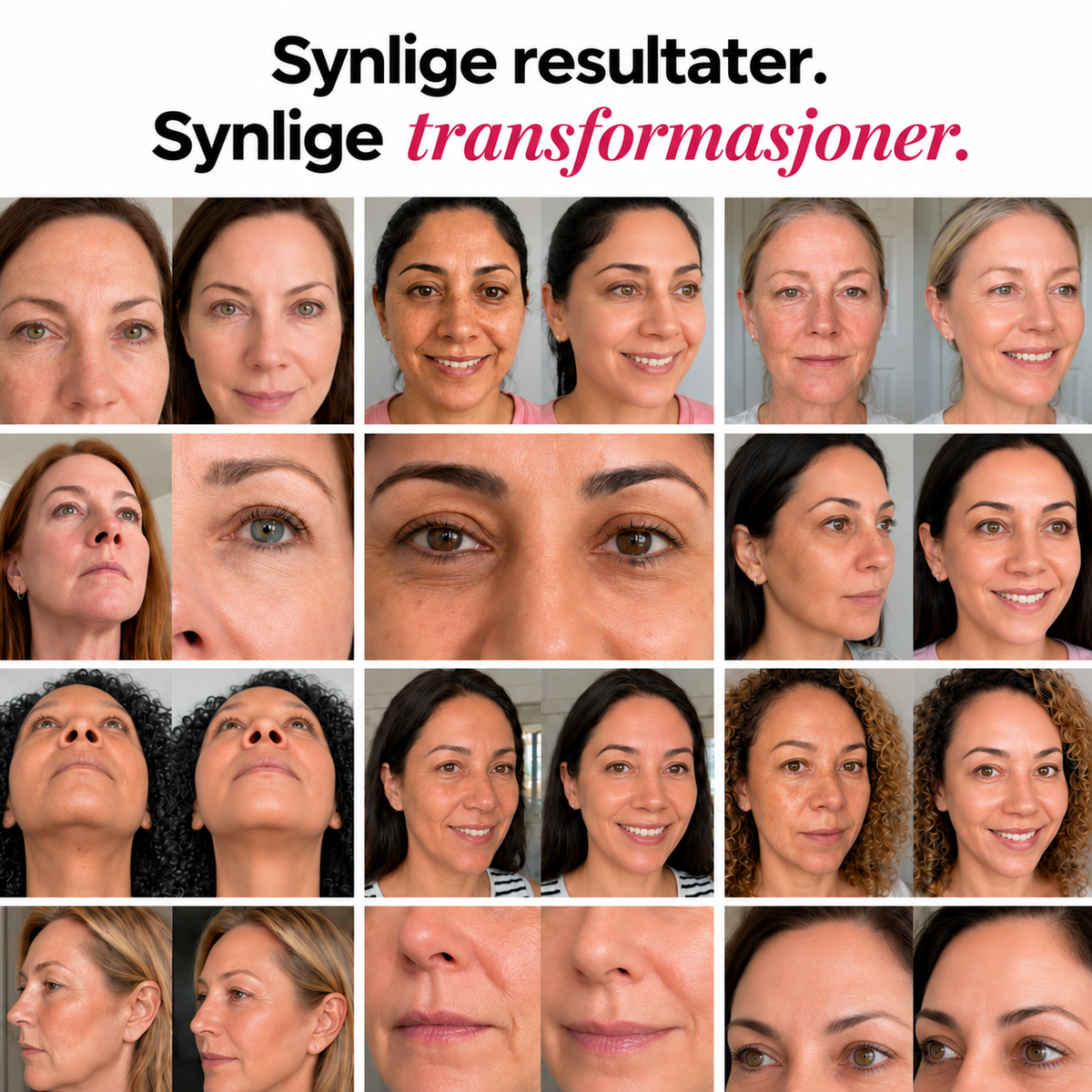 Collagen Volume Balm – For rynker og slapp hud