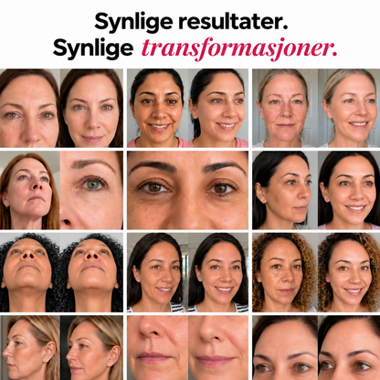 Collagen Volume Balm – For rynker og slapp hud