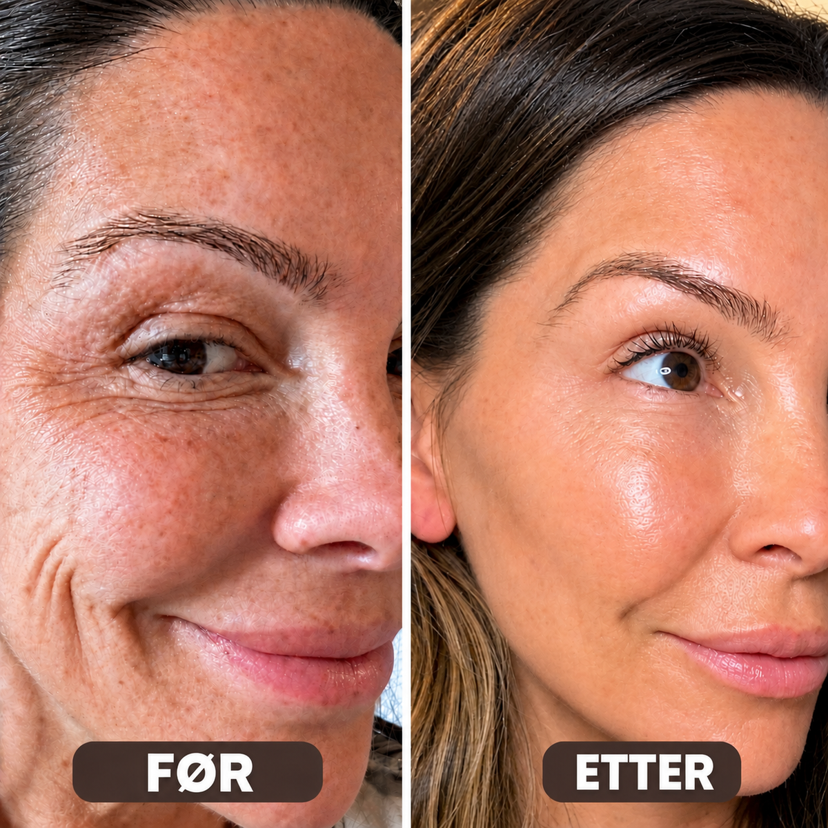 Collagen Volume Balm – For rynker og slapp hud